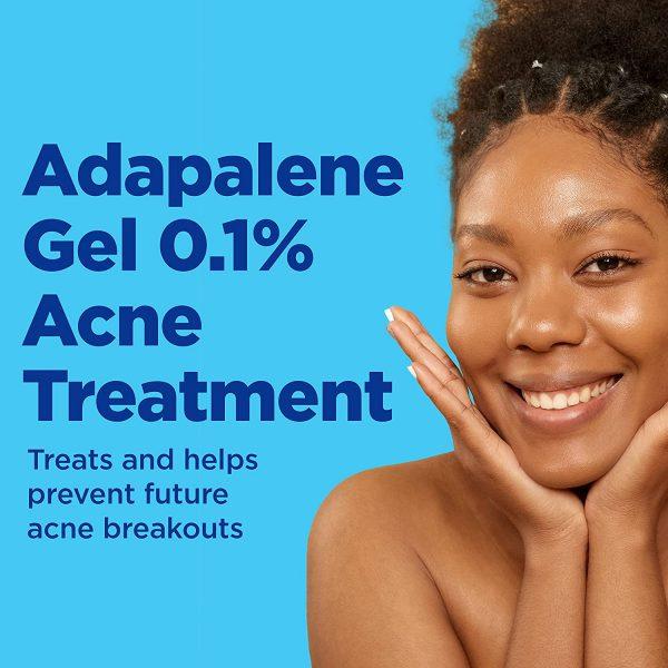 Differin Acne Treatment Gel, Retinoid Treatment for Face with 0.1% Adapalene, Gentle Skin Care for Acne Prone Sensitive Skin