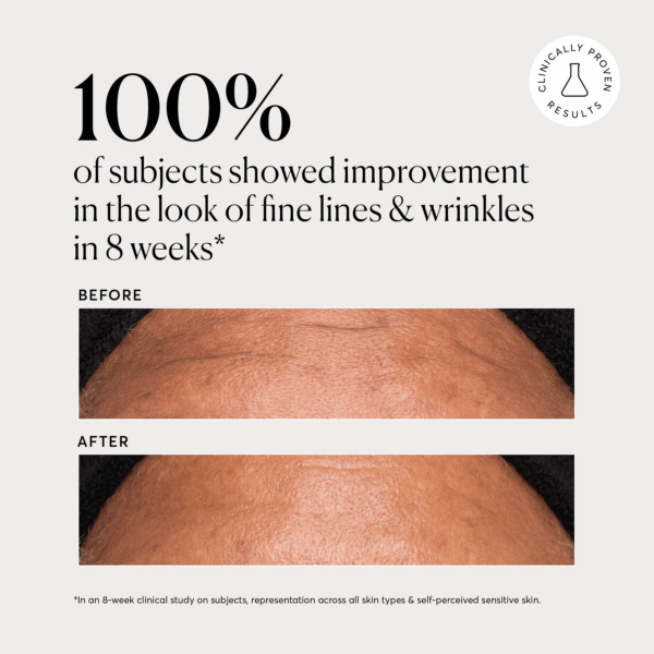 Before and after forehead closeup shows fewer fine lines and wrinkles after eight weeks using Naturium Multi Peptide Rich Cream