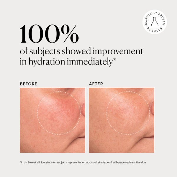 Before and after cheek closeup shows hydration improvement immediately after using Naturium Multi Peptide Rich Cream