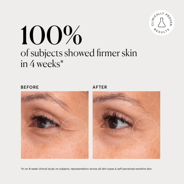 Before and after eye area shows firmer skin after four weeks using Naturium Multi Peptide Rich Cream with dotted circle highlight