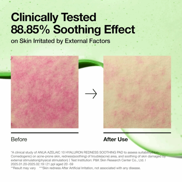 Closeup skin panels labeled before and after use with note of 88.85 percent soothing effect on irritation from external factors.